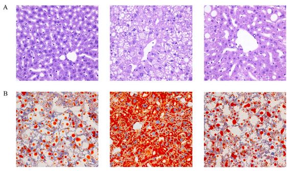 Fig. 2. ECH attenuated liver tissue structural disorder and lipid accumulation in mice with NAFLD. Fig. 2. ECH attenuated liver tissue structural disorder and lipid accumulation in mice with NAFLD.