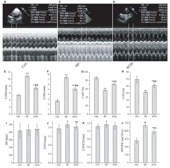 FIGURE 2 Cardiac hypertrophy of HF rats induced by ISO is relieved and heart function is significantly improved by ECH treated. FIGURE 2 Cardiac hypertrophy of HF rats induced by ISO is relieved and heart function is significantly improved by ECH treated.