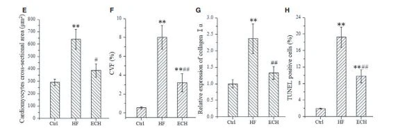 FIGURE 3 Results of histological staining demonstrate that ECH reverses left ventricular remodelling of HF rats induced by ISO. FIGURE 3 Results of histological staining demonstrate that ECH reverses left ventricular remodelling of HF rats induced by ISO.